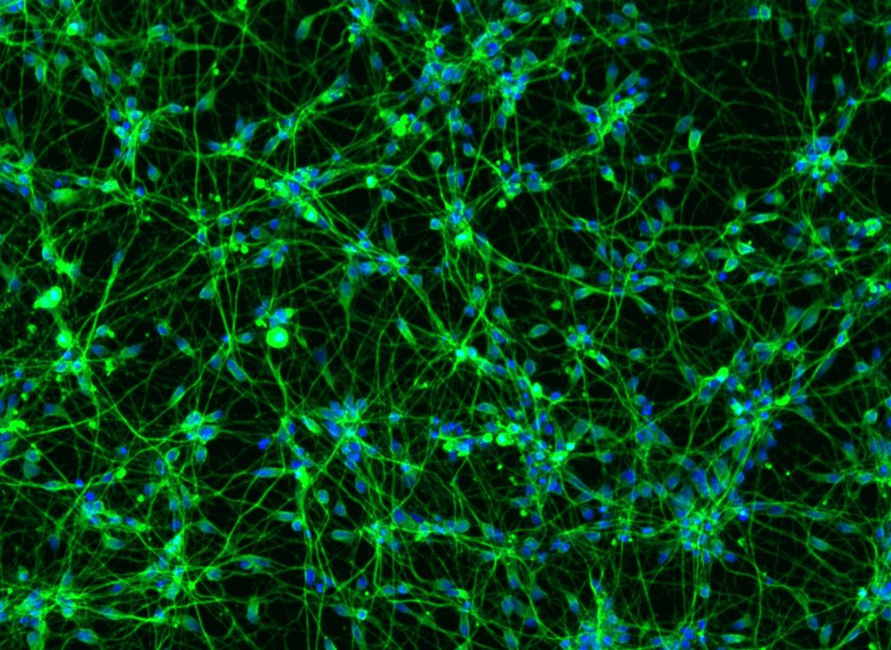 Clusters of neuronal cell bodies, coloured in blue, and surrounded by a network of neuronal projections, visible in green.