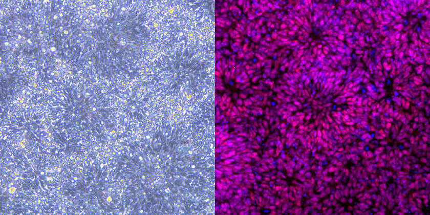 Images of human neural stem cells