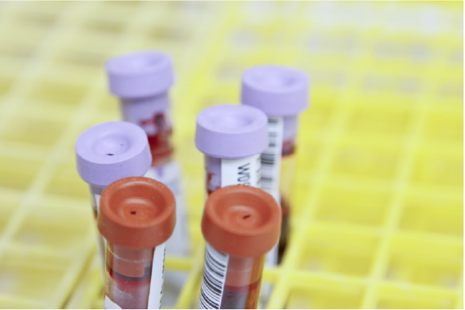 Red and purple test tubes of blood in a yellow tube holder.